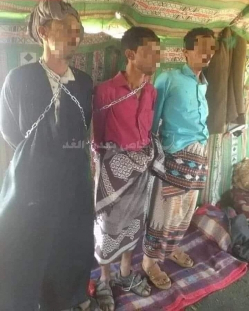 قتال "هادي و محسن" من أوجب الواجبات : أبنا محافظته يكبلون بسلاسل الحديد أذلاء
