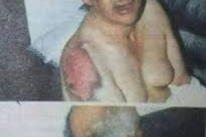  السقاف العظيم ضرب فصمتوا&hellip; واليوم يتباكون على حريةٍ انتقائية.. ديمقراطية اليوم ترى بعين واحدة