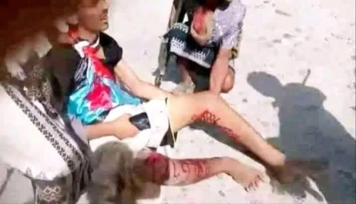 انتقالي حضرموت يصدر بيانًا مهمًا بشأن استهداف المتظاهرين وسقوط جرحى