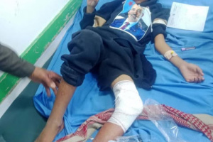 شبوة برس ينشر أول صور لأشبال شبوة الجرحى برصاص قوات اللواء الأول دفاع شبوة