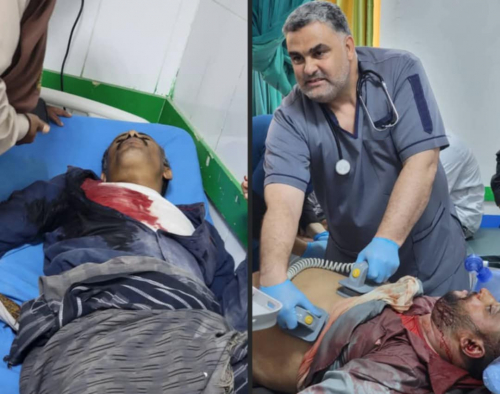 تحطيم منصة الاحتفال في شبوة: دليل على النوايا المسبقة ومجزرة مقززة للمتظاهرين