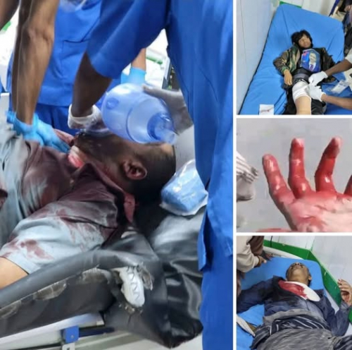 البيض: سنرفع قضية جريمة قتل متظاهري شبوة إلى المنظمات الدولية