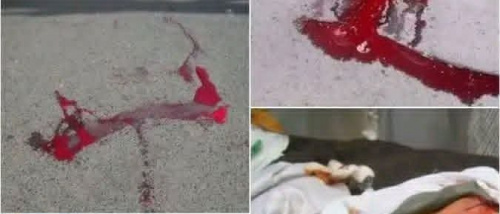 إدانات حقوقية دولية تفتح باب التحقيق في جريمة شبوة وتبعث الأمل للجنوبيين