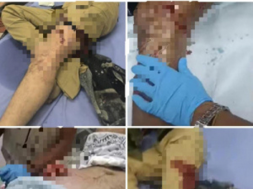 عاجل.. إصابات بين محتجين إثر إطلاق نار قوات الاحتلال اليمني على بوابة معاشيق في عدن (صور)