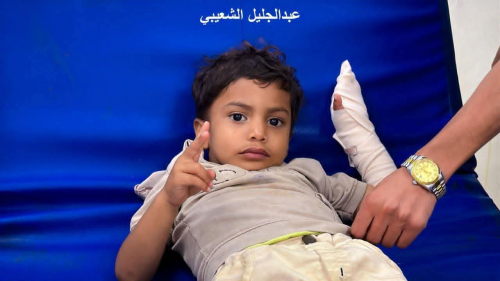 مجزرة معاشيق&hellip; شهيد وعشرون جريحًا بينهم أطفال برصاص درع اليمن في عدن