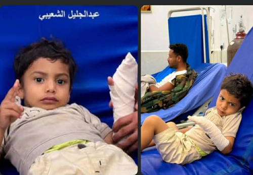 لجنة عدن الأمنية تحت مجهر الشارع&hellip; رواية السلاح في مواجهة صورة الأطفال الجرحى