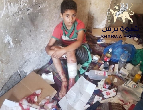مأساة تعز قتل المدنيين بسبب ثأر سياسي حزبي .. وجنوبيي الشرعية لم يهزهم هذا الوضع الإنساني
