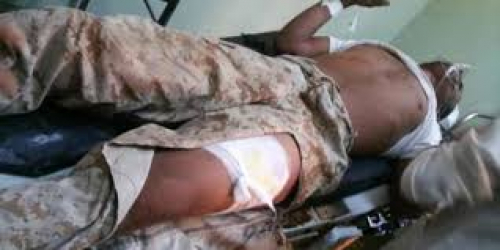 من قتل جنودنا اليوم؟! قتلهم ما يردد في قنوات بلقيس والمهرية بأنهم مليشيا الامارات