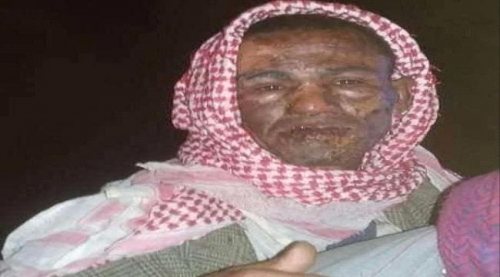 جريمة بشعة.. شباب اب يضرمون النار بجسد مختل عقلياً