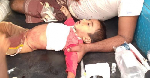 استشهاد طفل بقصف صاروخي حوثي على منازل المواطنين في تهامة