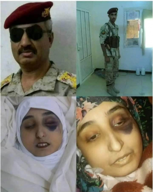 اصلاح مارب يخطف النساء والاطفال.. العميد الحوشبي تمت تصفيته جسدياً مع ابنته صفاء