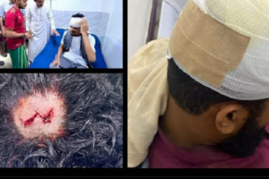  إصابات عن اطلاق نار في المكلا نتيجة فوضى سلاح مليشيا الغزو اليمني 