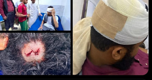 فوضى السلاح تضرب ساحل حضرموت.. والمكلا تحت وابل الرصاص في الأعياد