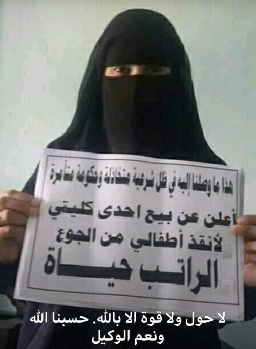 عدن تواجه حرب أمنية حوثية وحرب شرعية خدماتية 
