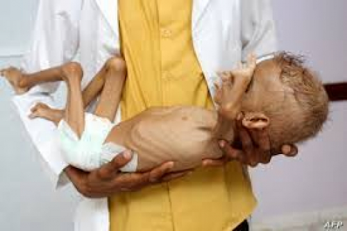 وباء الكوليرا يهدد عدن: 156 حالة في مركز العزل بمستشفى الصداقة
