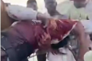 عاجل: مليشيات تكفيرية تقتل الشهيد باجامع وتصيب عشرات المتظاهرين في المكلا (صور)