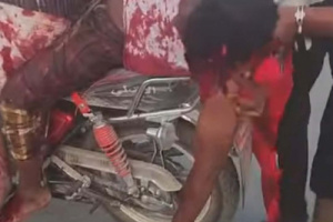 عاجل: ارتفاع عدد شهداء المكلا إلى ثلاثة شبان برصاص القوات خلال الفعالية السلمية