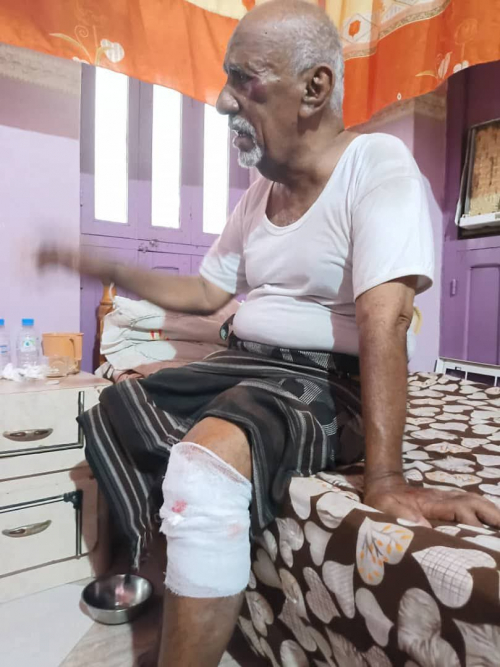 حتى كبار السن لم يسلموا.. رصاص مجرمي سلطة الأمر الواقع يصيب العميد الركن باعوض المحمدي 