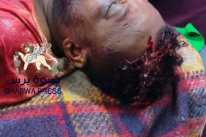 كل أبناء الجنوب ينتفضون غدًا لإسناد حضرموت