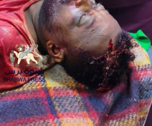 كل أبناء الجنوب ينتفضون غدًا لإسناد حضرموت