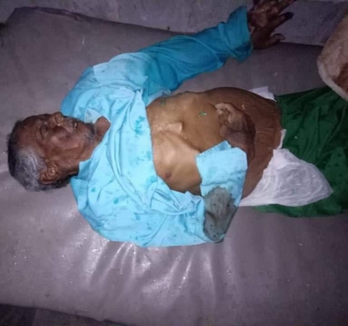 إدارة مستشفى عتق تحمل المحافظ "بن عديو" ومساعده "لمروق" مسؤولية إهمال المريض المسن المتوفى 