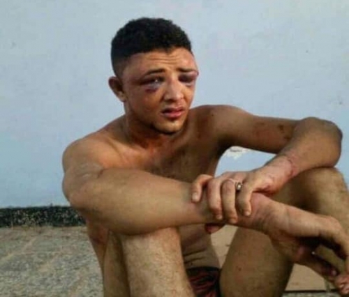 معسكر لواء النقل بعدن سجن لاختطاف وتعذيب أبناء عدن