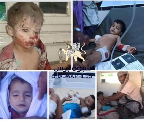 إلى قيادة المملكة .. السلاح السعودي يقتل النساء والأطفال في مدينة نصاب 