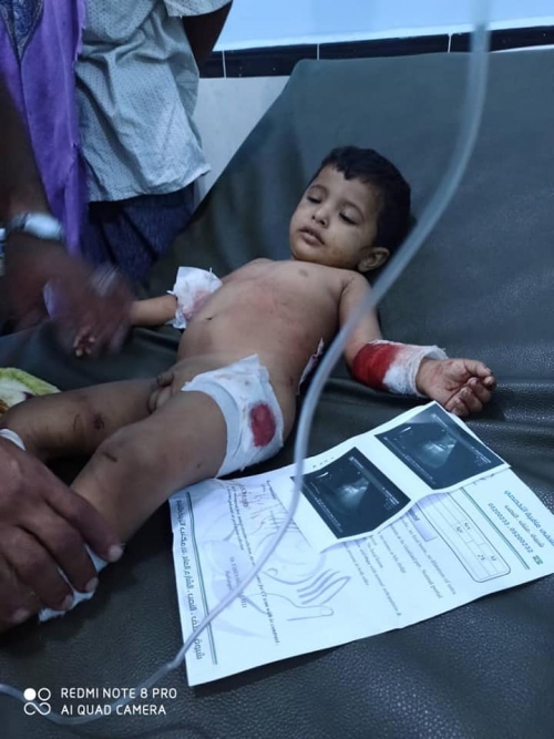 ميليشيا الإخوان تعرض 10 مليون لأسرة آل بوشمس شريطة تحميل الانتقالي مسؤولية قصف منزلهم وأطفالهم 