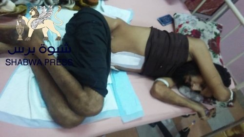 أين ذهبت أموال الجرحى .."الجريح الذي لم تشفعّ لهٌ بٌطولاته في ميادين القتال"