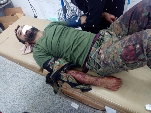 عـاجـل : بعد هزيمتها العسكرية المذلة : الشرعية تلجأ للإرهاب وتستهدف قائد الحزام الأمني