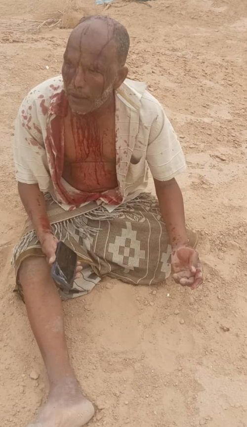 عضو الجمعية الوطنية العم "عبدالناصر مرجان" يتعرض للضرب والإهانة في سيئون