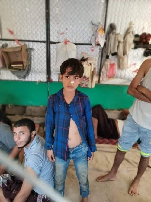  في مأرب: اعتقال طفل جائع عمره 10 سنوات بتهمة تدبير انقلاب على السلطة
