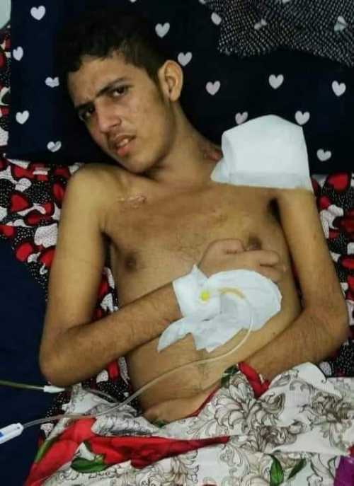 مناشدة إنسانية لإنقاد جريح مصاب بشللٍ "إعاقة كاملة".