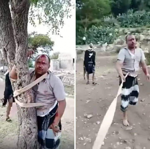 مواطن يسحب بحبل كالبهيمة ويربط إلى شجرة ويضرب ويهان في تعز.. أين نباحي حزب الإصلاح