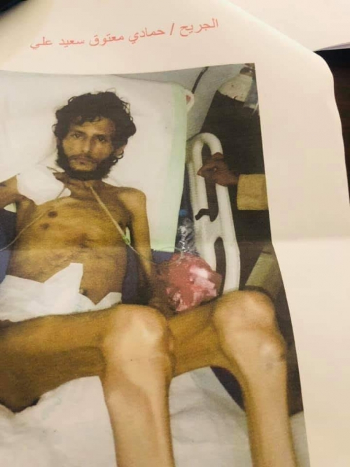 بسبب عقوبات الشرعية : وفاة جريح جنوبي لعدم حصوله على جواز سفر للعلاج في الخارج 
