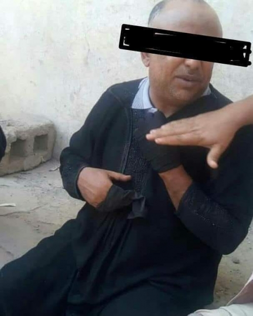 القبض على يمني متنكر بملابس نسائية في مديرية لودر للقيام بعمل مخابراتي