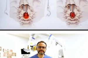 جراح مصري يدهش العالم بأول عملية من نوعها في تاريخ الطب الحديث