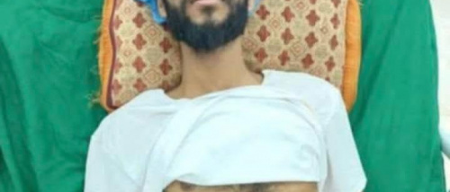 الشرعية تترك جريحًا قاتل 10 سنوات بينما تنفق المليارات على السفلة واللصوص