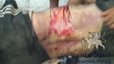 قوات الأمن بعدن تعذب  شابا من أبناء دار سعد حتى الموت  وتدعوأسرته لاستلام جثته من الثلاجة (صور )