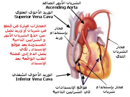 النوبات القلبية أكثر شيوعا بين العاطلين عن العمل