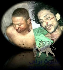 والدي الشهيدين العامري الخليفي والمنهجر الحبشي يؤكدان للبيض : من أجل الجنوب سندفع بأبنائنا كلهم والتشييع يوم غداً ..