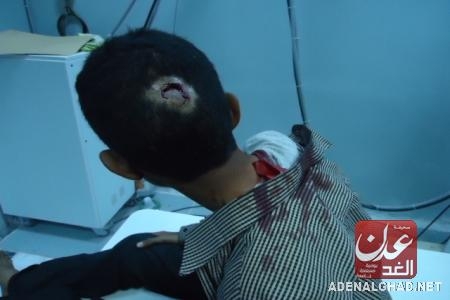 شبوة برس - تعتذر ,لمازن العمدة’ وتتمنى الشفاء لجرحى المنصورة
