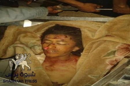 وفاة شاب في حادث مرور في عتق - الصعيد