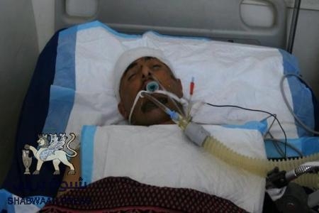 وفاة الناشط السياسي محمد احمد موسى الشعيبي الليلة في عدن