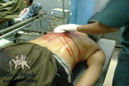 تصحيح لخبر سقوط شهيد في العريش