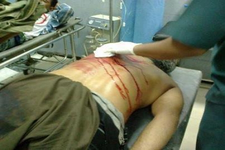 شهيد جديد في ساحة الحرية بخور مكسر من أبناء ردفان حبيل جبر (ت) السادسة