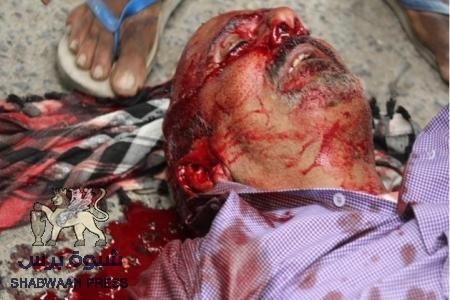 عاجل: إرتفاع عدد شهداء ملحمة الكرامة بعدن الى 9 بعد استشهاد احد الجرحى قبل قليل.