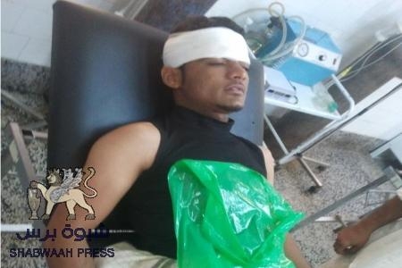 قوات الإحتلال اليمني تعتدي بوحشية على المواطن الجنوبي عبدالله نصيب العامري في سيئون
