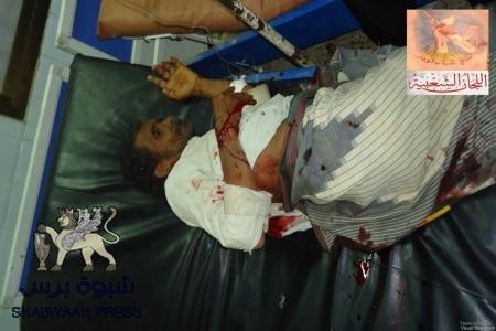 الصور الاولى لضحايا تفجير لودر ( صور مؤذية)