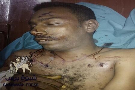 شبوة برس : تنشر صورة ياسر حمدان قتيل القطن
